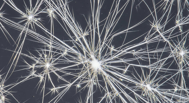 Dandelion Seed Head Close Up