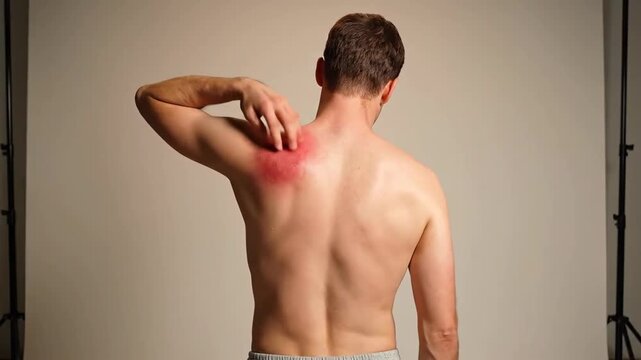 Shoulder Pain Examination: A Visual Guide on Recognizing Possible Skin Irritation