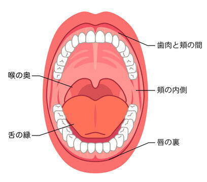 口内炎の出来やすい場所　口の中　医療
