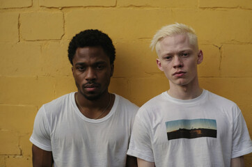 A black guy and an albino guy are standing near a yellow wall