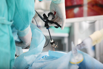 Laparoscopic surgery. Surgery on internal organs. A modern surgical method. Operations through small holes in the abdominal cavity.