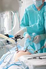 The doctor performs the operation using a micro-camera and a special laparoscopic instrument. Laparoscopic surgery. Penetration into the abdominal cavity. A team of surgeons.