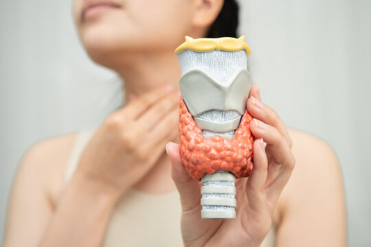 Hyperthyroidism, Overactive Thyroid, Thyroid Lymphoma, Asian woman with thyroid gland human anatomy model.
