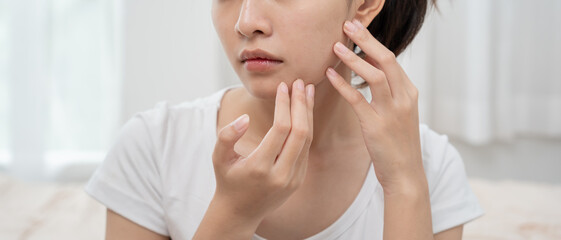 Young woman are worried about faces Dermatology and allergic to steroids in cosmetics. sensitive skin, red face from sunburn, acne, allergic to chemicals, rash on face. skin problems and beauty