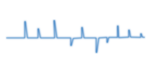 heart beat cardiogram