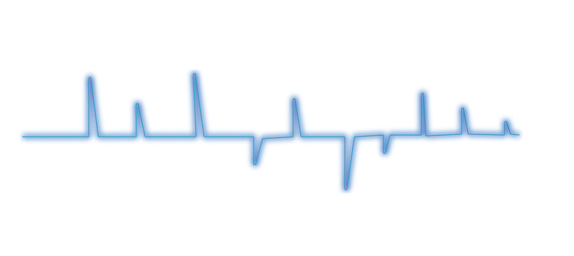 heart beat cardiogram - Powered by Adobe
