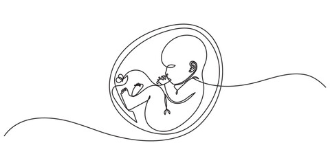 Baby embryo in womb one line drawing. Cute unborn fetus baby on mother womb isolated on white background, Baby embryo in womb in one continuous line drawing. Healthy pregnancy and premature symbol.