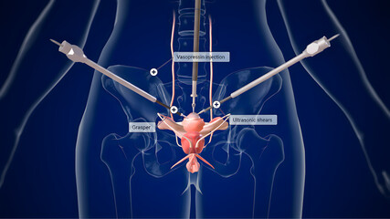 High-resolution illustration of the human spinal cord and surrounding nerves, designed for medical education, anatomical reference, and scientific presentations.