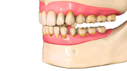 Anatomical illustration showing the full upper and lower teeth, gum structure, and dental alignment for dentistry learning and scientific study.