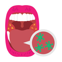 Mouth Infection Illustrator