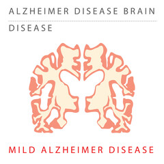 ALZHEIMER Mild alzheimer disease