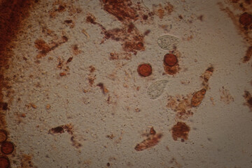 Microscopic Field View of a Putrefaction Sample, Revealing Fungal Spores, Microbial Debris, and...