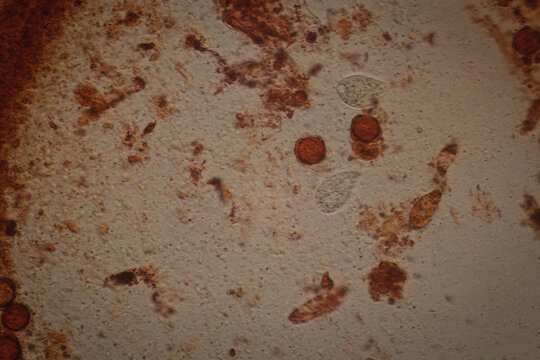 Microscopic Field View of a Putrefaction Sample, Revealing Fungal Spores, Microbial Debris, and Protozoan Life