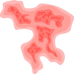 Zoster virus illustration