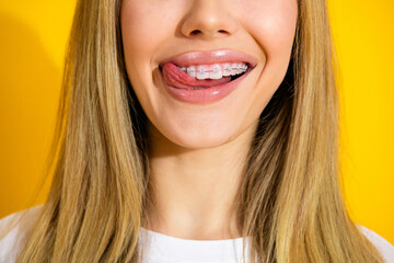 Young woman with braces smiles playfully against a bright yellow background highlighting dental...