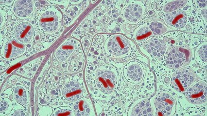 Microscopic examination of tissue cells revealing distinct rod-shaped bacterial presence and proliferation