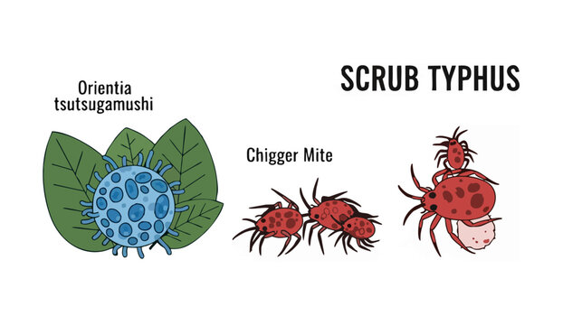 Scientific illustration of Scrub Typhus disease, showing the causative bacteria, Orientia tsutsugamushi, and its vector, the chigger mite. Medical-biological design.