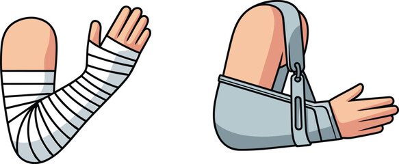 Injured arm illustration showing wrapped bandage and arm sling support, representing medical care, fractures, sprains, rehabilitation, first aid treatment, and orthopedic recovery concepts.