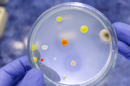 Growth inhibition zones around bacterial colonies, illuminated by backlight, bacteria secrete growth inhibitory substances against other bacteria.