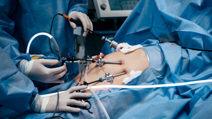 Surgical team performing minimally invasive procedure using advanced instruments on patient,...