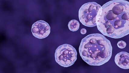 A 3D rendering of hypersegmented neutrophils. Their nuclei show an abnormality, divided into multiple, clearly visible segments (six or more lobes). This is often a sign of megaloblastic anemia.
