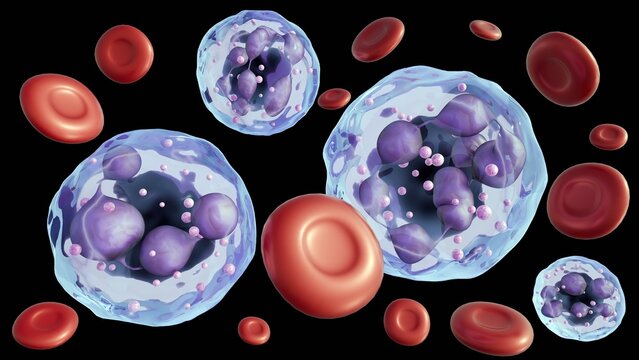 3D rendering of healthy erythrocytes and hypersegmented neutrophils. This is a classic diagnostic finding, most often linked to Megaloblastic Anemia.