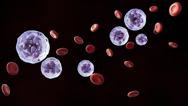 3D rendering of healthy erythrocytes and hypersegmented neutrophils. This is a classic diagnostic finding, most often linked to Megaloblastic Anemia.