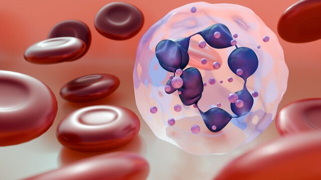 3D rendering of healthy erythrocytes and hypersegmented neutrophils. This is a classic diagnostic finding, most often linked to Megaloblastic Anemia.
