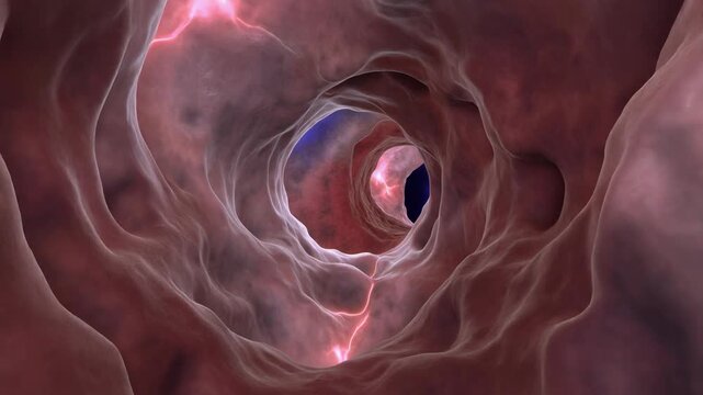 Medical Visualization: Journey Through the Occipital Sinus