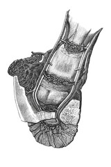 The vascular network of the equine distal limb, showing arteries and veins supplying the hoof structures, old vintage illustration, 1889