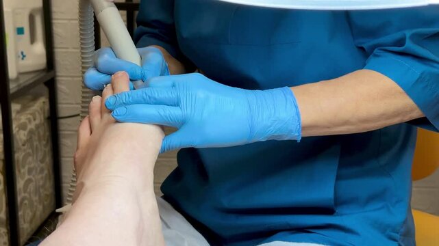 Hardware medical pedicure using a drill and nail files. A patient has a pedicure at a podiatrist. A dangerous fungal lesion of human toenails. Onychomycosis, treatment of nail fungus.