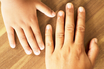 Hands in Unity on Rustic Background