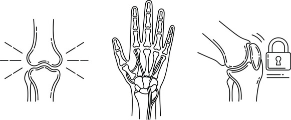 Set of joint and bone illustrations showing knee pain, hand skeleton anatomy, and locked joint concept for medical, orthopedic, and health education graphics