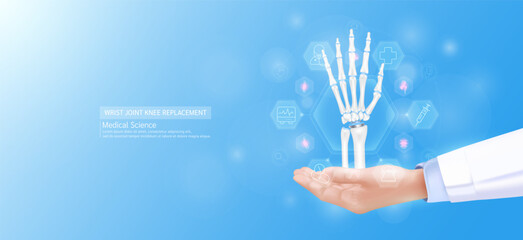 Wrist joint replacement model in doctor hand. Hand joint bone surrounded by medical icons. Technologies in science health care. Realistic 3D Vector.