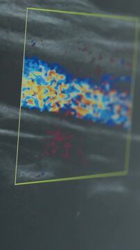 color Doppler ultrasound showing arterial flow grayscale soft tissue background, color box highlights blue and red flow, cine frames reveal changing waveform and velocity sonographer maneuvers