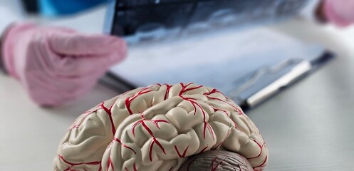 Obraz premium Doctor checks x-ray of brain using ST segment scanning. MRI of brain.