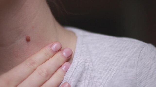 A woman examines her mole on her neck close-up
