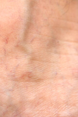 Close-Up of Human Skin Detail with Natural Texture and Imperfections