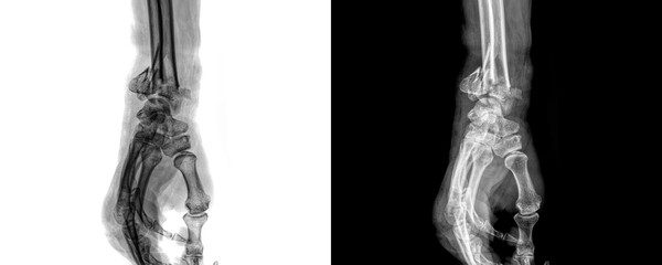 Wrist Joint Lateral View X-Ray Radiograph Depicting Bone Integrity, Joint Spacing, and Soft Tissue Shadows for Clinical Diagnosis and Evaluation, Isolated on Transparent