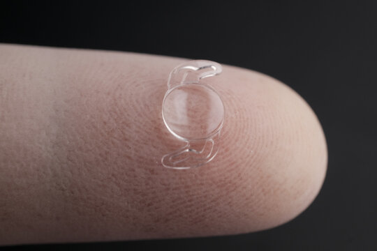 The Flexible Foldable Intraocular Lens (IOL): A Biocompatible Acrylic Implant Used in Minimally Invasive Phacoemulsification Cataract Surg