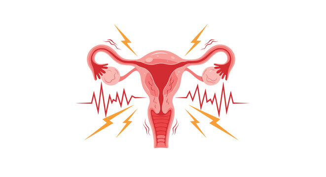 Medical illustration of a female uterus with ovaries experiencing pain, cramps, and spasms, symbolizing menstrual or reproductive issues.