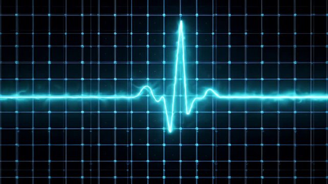 Neon Blue Electrocardiogram Trace Over a Dark Grid Background with Heartbeat Spike