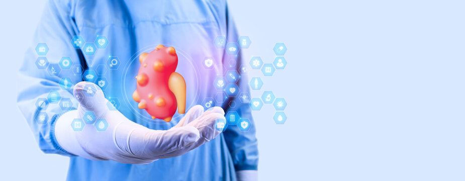 A urologist displays a kidney with renal cysts and medical icons. Concept of kidney health, modern digital diagnosis of polycystic kidney disease. Doctor isolated on a light blue background