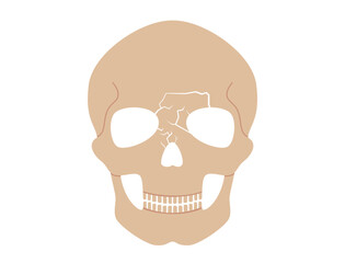 Nasal fracture poster