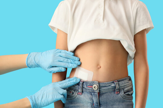 Doctor applying medical patch on girl's belly after appendectomy surgery against blue background, closeup
