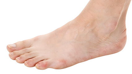 Closeup of bare feet of a young woman on white background concept health beauty and care