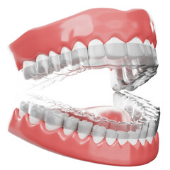 Obraz premium Dental Mouth Guard on Teeth