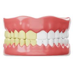Obraz premium Dental Model Showing Teeth Whitening Process