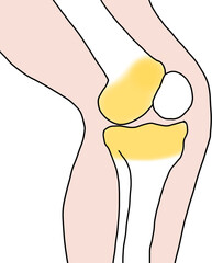 무릎 뼈 성장판