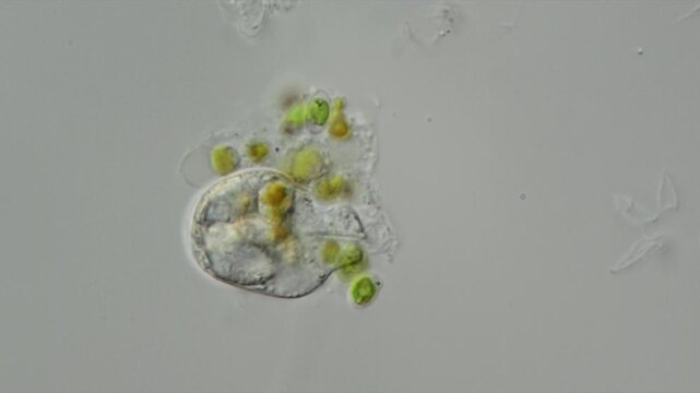 Ein Einzeller frisst einen anderen Einzeller durch Phagocytose, Mikroskopfilm
